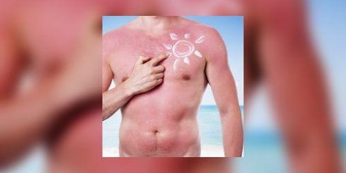 Le « sunburn art » : la mode a ne pas suivre