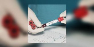 Le sida : premier cas de remission prolongee pour cette jeune Francaise de 18 ans