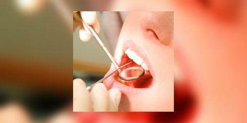 Le depistage des cancers de la bouche se fait chez le dentiste ! 