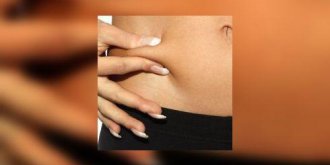 La liposuccion : une perte de poids definitive ?