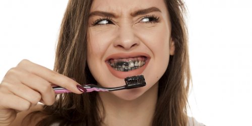 Dentifrice au charbon, un danger pour les dents ?