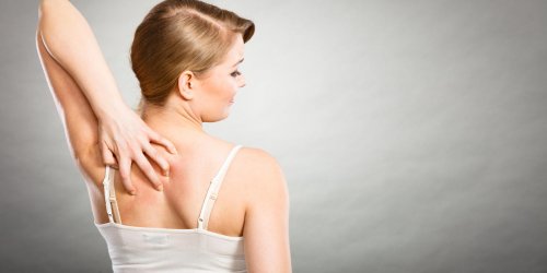 Eczema : le point sur les 3 formes existantes