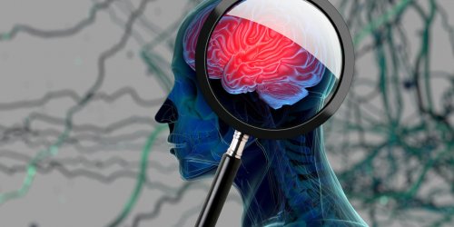 Migraine : decouverte d-une nouvelle zone impliquee dans la douleur