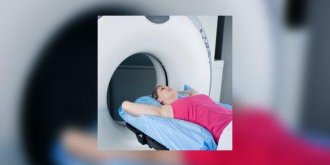 Radiotherapie : une piste pour traiter les mycoses buccales