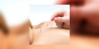 Radiotherapie de la tete et du cou : prevenir l’effet « bouche seche » grace a l’acupuncture