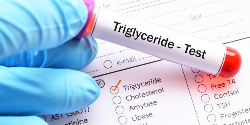Triglycerides : 6 facons de les diminuer