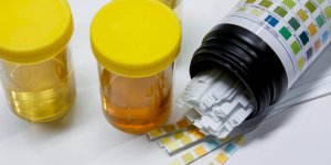 Uriner du sang : qu-est-ce que l-hematurie ?