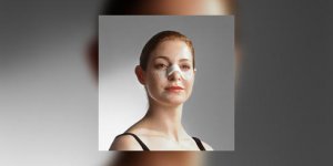La rhinoplastie, l-operation esthetique du nez