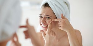 Acne a l’age adulte : comment s-en debarrasser ?