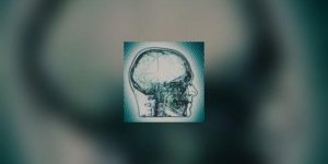 Cerebrotheque Parkinson : don de cerveau pour la recherche