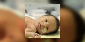 Rhesus negatif et grossesse : quelles consequences ?
