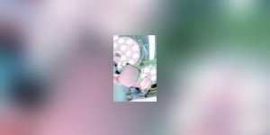 Chirurgie de la main : peut mieux faire