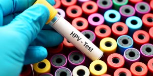 Sexe oral et papillomavirus