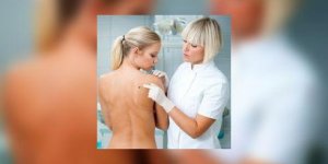 Melanome : etes-vous a risque ? Comment examiner votre peau ?