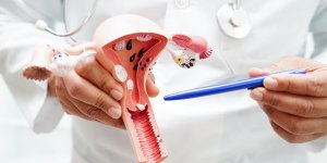 Cancer du col de l’uterus : l’ajout d’un type de traitement a la therapie proposee reduirait les risques de recidive de 35 %