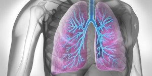Cancer du poumon : douleurs et pronostic