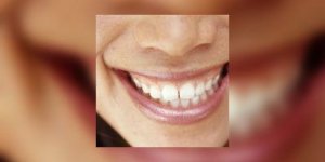 Vos dents, votre age et vous