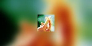 Le sida menace toujours, la prevention ciblee s-organise