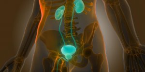 Prostatite chronique : a quoi est-elle due ?