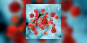 Mort des cellules cancereuses, un silence coupable