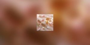Anti-inflammatoires : quelques regles pour un bon usage !
