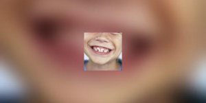 L-orthodontie : ca fait mal ?