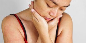 Maladie de peau : et si c’etait une depression ?