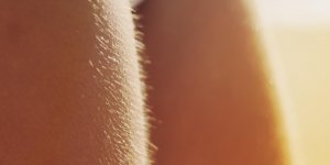 Exces de poils ? De l-hyperpilosite a l-hirsutisme