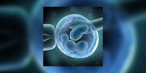 Aide a la procreation : qu-est-ce que la fecondation in vitro ?