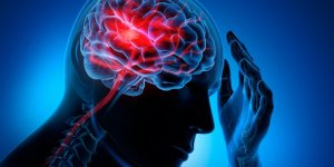 Accident vasculaire cerebral : connaissez-vous les signes d-alerte ? 