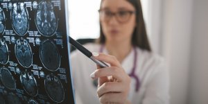 Anevrisme cerebral : quels sont les symptomes ?