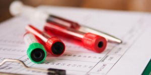 Hypoglycemie : quand la glycemie est trop basse