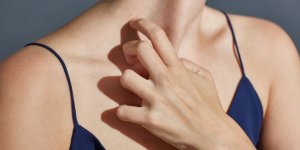 Rougeurs ? Mieux vaut prevenir... 