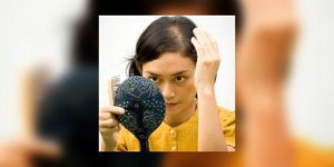La pelade : quand les cheveux partent par plaques…