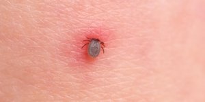 Maladie de Lyme : que faire en cas de morsure de tique ?