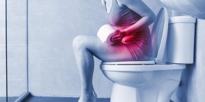 Occlusion intestinale : le role de la constipation