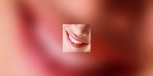 A bonnes dents, belles arteres