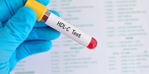 Bilan lipidique : le cholesterol HDL a un role important