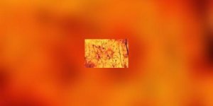 Les antidepresseurs donnent naissance a de nouveaux neurones