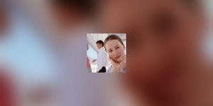 Que savez-vous sur le psoriasis ?