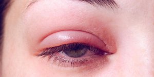 Orgelet : a quoi est du ce "bouton" de l-œil ?
