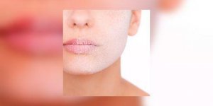 Psoriasis : les proches, premier soutien