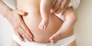 Naitre par cesarienne rend plus vulnerable a l’inflammation a l’age adulte