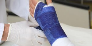 Fracture d’osteoporose : cinq differences hommes-femmes 