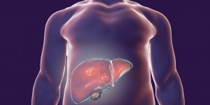 Les principaux symptomes d-une hepatite B