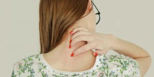 Urticaire : le stress joue un role majeur