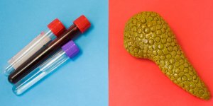 Quelles sont les causes d-un cancer du pancreas ?