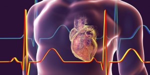 Insuffisance cardiaque droite : comment la reconnaitre