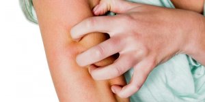 Vivre avec un psoriasis 