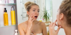 Acne et adolescence : comment bien vivre son traitement ?